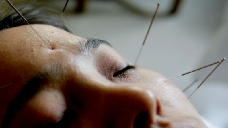 A acupuntura é uma excelente aliada para mover as estagnações, eliminar fatores patógenos exteriores e melhorar as funções respiratórias, desobstruindo as vias respiratórias. (China Photos/Getty Images)