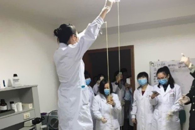 Médicos retiram enorme parasita do corpo de um chinês