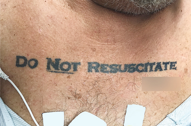 Médicos enfrentaram um dilema ético quando descobriram um homem morrendo com uma tatuagem dizendo "Não Ressuscitar" em seu peito (The New England Journal of Medicine ©2017)