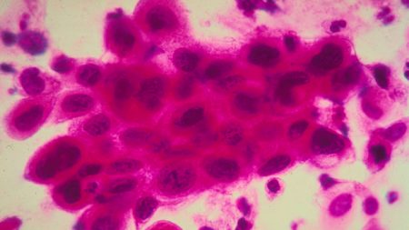 Cientistas descobrem célula que poderá tratar todos os tipos de câncer