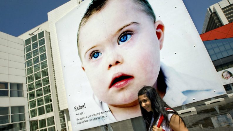 Campanha alerta sobre extinção de crianças com Síndrome de Down