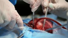 3 maneiras pelas quais a ciência pretende acabar com a escassez de órgãos