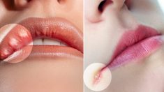 Dez pistas que seus lábios lhe dão sobre sua saúde: formigamento nos lábios pode significar derrame