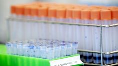 Testes em larga escala farão ‘explodir’ casos de coronavírus no Brasil