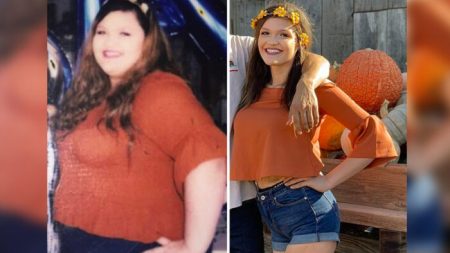 Mulher viciada em fast food recria foto após perder mais de 196 libras