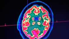Homem na Flórida morre de infecção por ameba “comedora de cérebro”