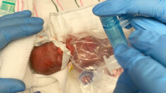 Bebê prematuro com 310 gramas consegue sobreviver na UTIN do hospital e finalmente vai para casa