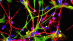 Pesquisadores desenvolvem técnica de nanotecnologia para restaurar neurônios danificados