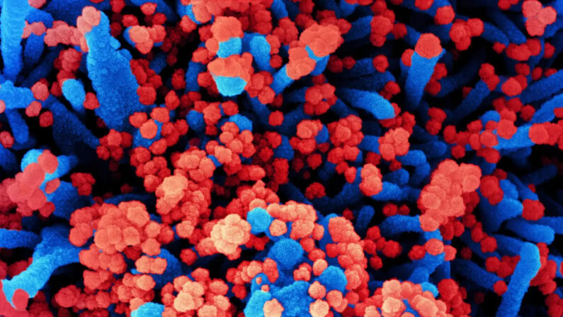 Micrografia eletrônica de varredura colorida sem data de uma célula (azul) fortemente infectada com partículas de COVID-19 (vermelho), isolada de uma amostra de paciente no NIAID Integrated Research Facility em Fort Detrick, Maryland, em 31 de outubro de 2020 (NIAID)