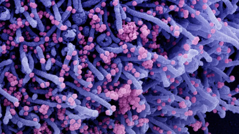 Micrografia eletrônica de varredura colorida de uma célula (roxa) infectada com uma cepa variante de partículas do vírus SARS-CoV-2 (rosa), isolada de uma amostra de paciente (NIAID através do Epoch Times)
