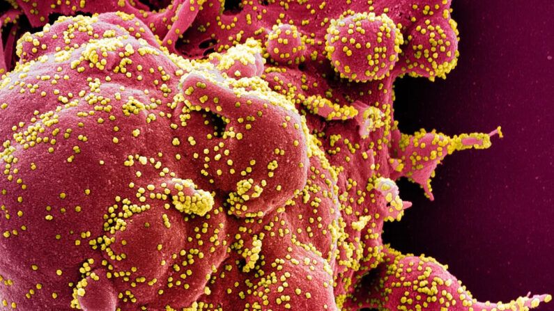 Micrografia eletrônica de varredura colorida de uma célula apoptótica (vermelha) fortemente infectada com partículas do vírus que causa a COVID-19 (amarelo), isolada de uma amostra de paciente. Imagem capturada no NIAID Integrated Research Facility (IRF) em Fort Detrick, Maryland, publicada em 2 de abril de 2020 (NIAID)
