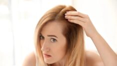 Queda de cabelo precoce: causas potenciais e dicas antigas para melhorar e prevenir