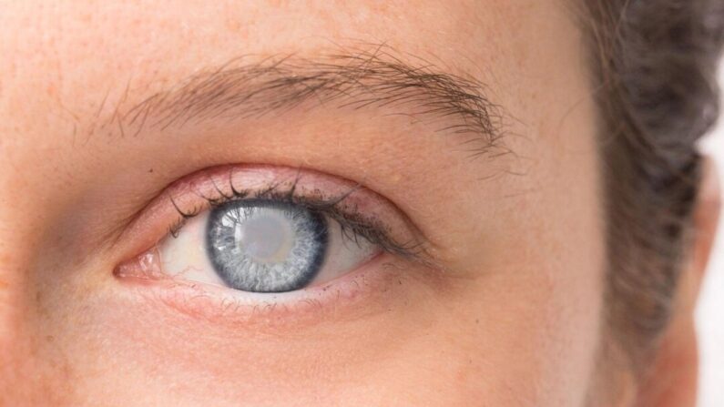 Doenças oculares quando não tratadas podem gerar problemas irreversíveis (sruilk/Shutterstock)
